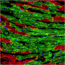 The baby and the bath water: adult cardiac stem cells revisited