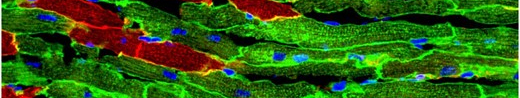The baby and the bath water: adult cardiac stem cells revisited