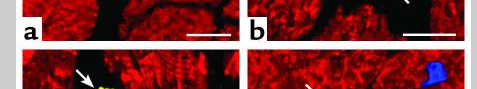 A matter of life and death: cardiac myocyte apoptosis and regeneration