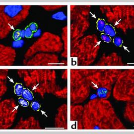 A matter of life and death: cardiac myocyte apoptosis and regeneration